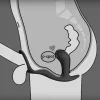 Anel Fun Factory Bootie Ring Antracite
